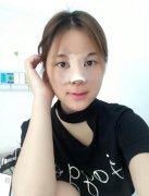 北京亞楠容悅整形蔣亞楠醫(yī)生隆鼻案例