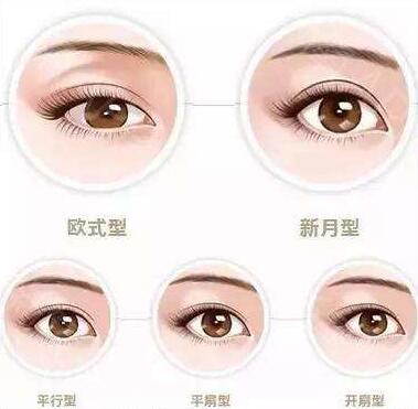 北京雙眼皮價(jià)格是多少