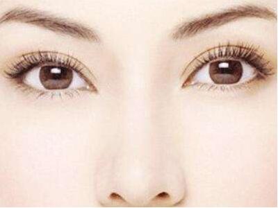 北京雙眼皮價格是多少
