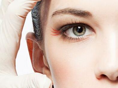 激光去魚尾紋保持多久 術后如何護理