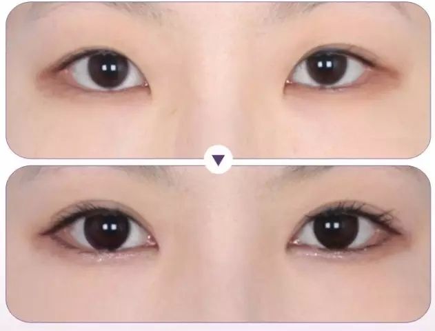 深圳*整形價格是多少