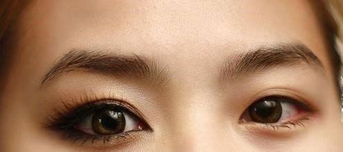 上海,開外眼角,多少錢