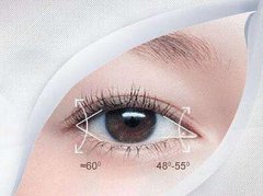 北京開眼角前后多少錢