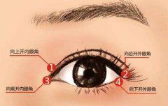 上海韓式開內眼角多少錢