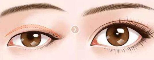 廣東,眼部提肌,多少錢