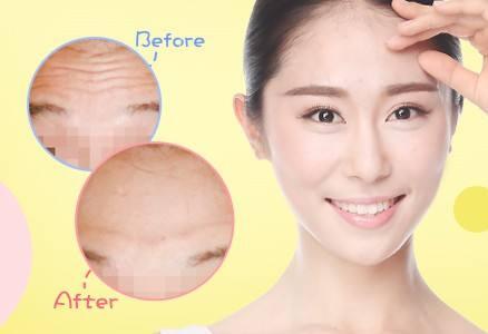 抬頭紋怎么調(diào)節(jié)