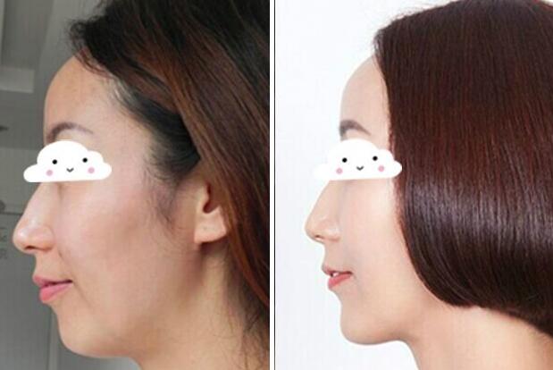 瑞蘭2號(hào)多少錢一支