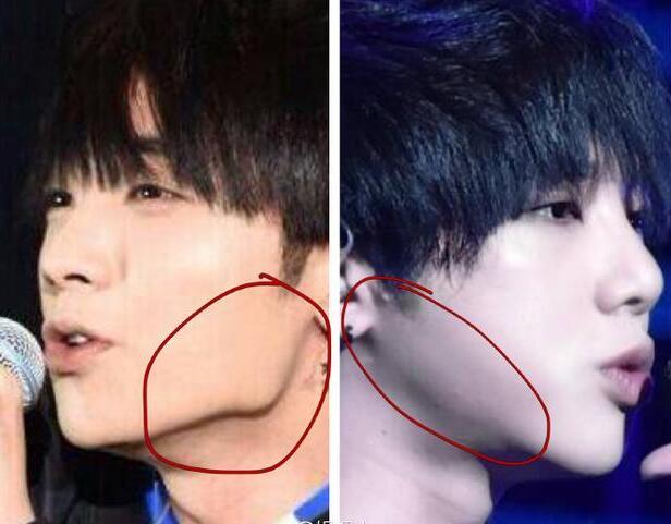 華晨宇整容前后照片 華晨宇做了下頜角整形？