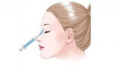 注射隆鼻的材料有哪些？那種好？多少錢(qián)？