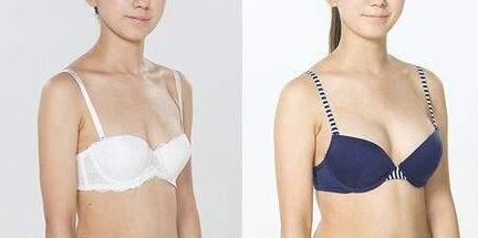 重慶假體豐胸,介紹,隆胸的優(yōu)勢(shì)