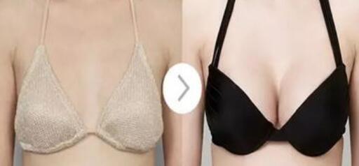 假體豐胸危害有哪些？假體豐胸有副作用嗎？