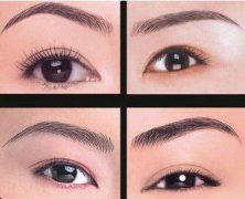 種植眉毛大概需要多少錢(qián)啊