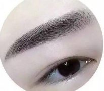 種植眉毛調(diào)節(jié)眉毛缺損手術(shù)是什么？