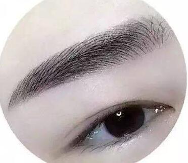 種植眉毛調(diào)節(jié)眉毛缺損手術(shù)是什么？