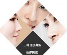 深圳膨體隆鼻整形費(fèi)用多少錢(qián)