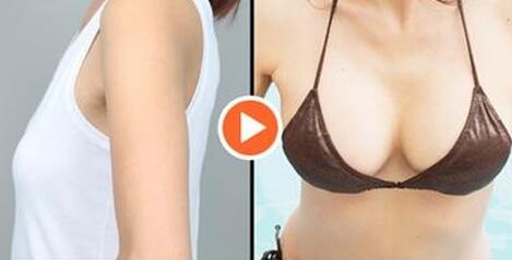 上海假體豐胸費(fèi)用、上海假體豐胸手術(shù)多少錢？