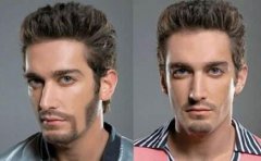 種植胡須充血怎么回事？種植胡須為什么會充血？