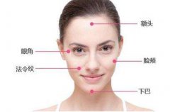 中面部提升術(shù)會維持幾年？中面部提升術(shù)會維持多久？