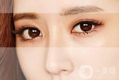 割雙眼皮的價(jià)格貴不貴？多少錢(qián)？