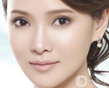 割雙眼皮要恢復(fù)多久 注意事項有哪些