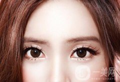 割雙眼皮價格是多少錢？收費明細~