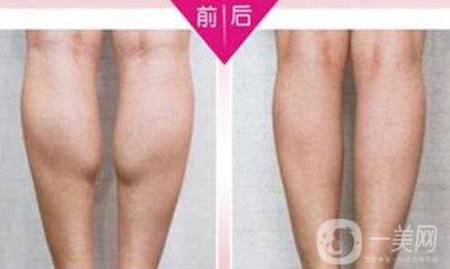 **果好嗎？*多少錢一針？