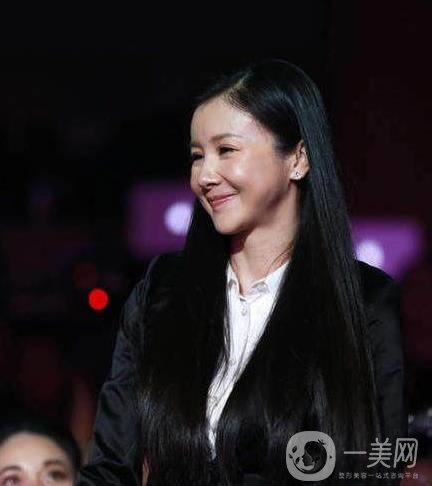 孫菲菲整容了嗎 孫菲菲整容前后圖片