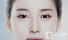 開眼角多久恢復 術后要如何護理