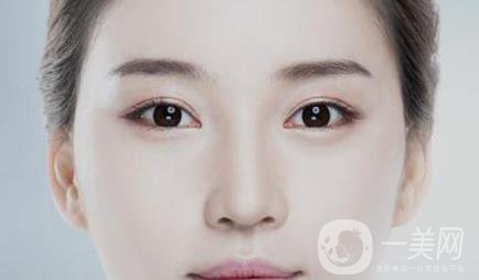 開(kāi)眼角多久恢復(fù) 術(shù)后要如何護(hù)理