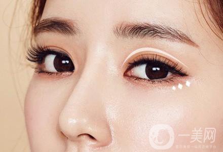 高分子雙眼皮是*嗎?高分子雙眼皮適合哪些人？