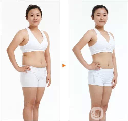 360吸脂減肥多久恢復(fù)正常?要注意些什么？