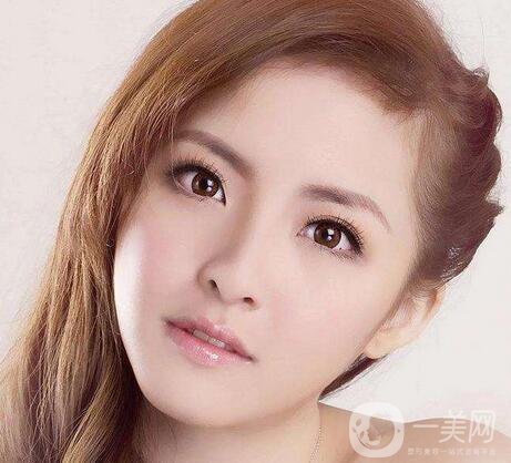 生物焊接雙眼皮價格一般是多少？