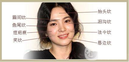 雙美膠原蛋白隆鼻怎么樣?*果能維持多久？