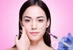 *要多少錢 *價(jià)格盤點(diǎn)