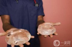 隆胸價(jià)格是多少？隆胸需要多少錢？