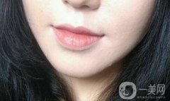 墊下巴后多久可以按摩 術后如何護理