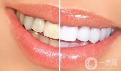 四環(huán)素牙怎么變白？四環(huán)素牙怎么辦？