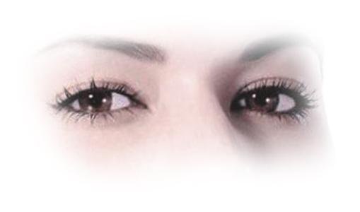 焊接雙眼皮是什么？手術后多久能好？