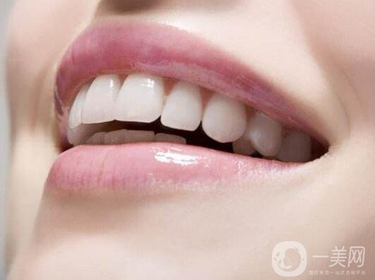 烤瓷牙價格和種類詳細(xì)介紹