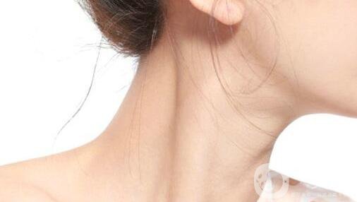 有頸紋怎么辦？去頸紋什么方法好？