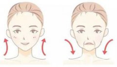 怎么除去法令紋？什么方法可以去法令紋？