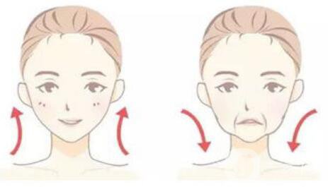 怎么除去法令紋？什么方法可以去法令紋？
