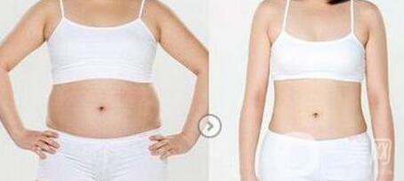 南京吸脂減肥的價(jià)格是多少？吸脂減肥大概多少錢？