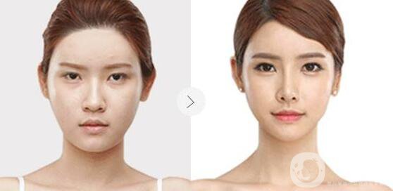 瑞蘭2號(hào),多少錢