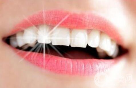 皓齒美白牙齒,多少錢