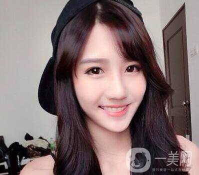 眼窩凹陷填充手術(shù)是什么 術(shù)后如何護(hù)理