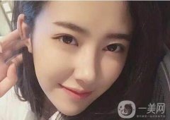 非手術(shù)隆鼻多少錢 非手術(shù)隆鼻價(jià)格介紹