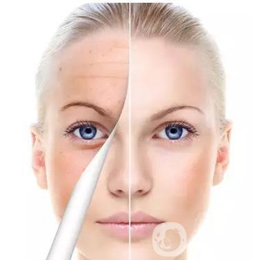 如何調(diào)節(jié)咖啡斑才*不反彈？