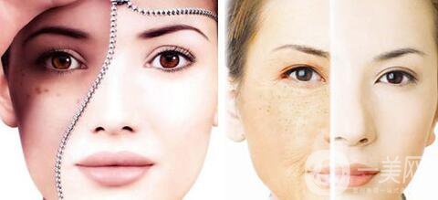 光子嫩膚價格多少、做光子嫩膚需要多少錢