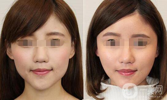 *大概要多少錢、*的費用詳解